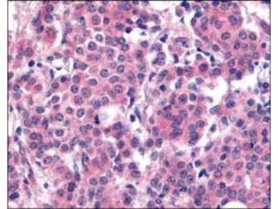Immunohistochemistry: PLK1 [p Thr210] Antibody [NBP1-78021]